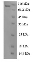 Recombinant Human Vascular endothelial growth factor receptor 2 (KDR), partial – Figure 1 of 1