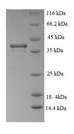 Recombinant Human PCNA-associated factor (PCLAF) – Figure 1 of 1