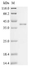 (Tris-Glycine gel) Discontinuous SDS-PAGE (reduced) with 5% enrichment gel and 15% separation gel.