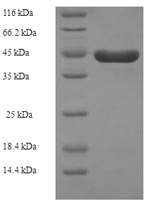 Recombinant Human Kit ligand (KITLG), partial – Figure 1 of 1