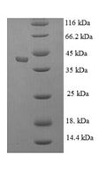 Recombinant Human Kallikrein-1 (KLK1) – Figure 1 of 1