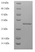Recombinant Rat Glandular kallikrein-7, submandibular/renal (Klk7) – Figure 1 of 1