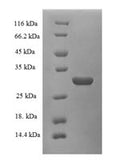 Recombinant Rat Plasma kallikrein (Klkb1), partial – Figure 1 of 1