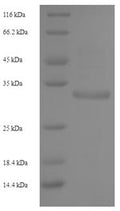 Recombinant Human NKG2-C type II integral membrane protein (KLRC2), partial – Figure 1 of 1