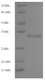 Recombinant Human NKG2-C type II integral membrane protein (KLRC2), partial – Figure 1 of 1