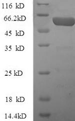 Recombinant Human Kynurenine 3-monooxygenase (KMO) – Figure 1 of 1