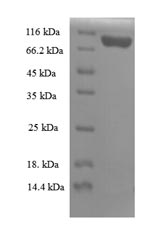 Recombinant Mouse Importin subunit beta-1 (Kpnb1) – Figure 1 of 1