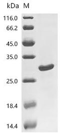 (Tris-Glycine gel) Discontinuous SDS-PAGE (reduced) with 5% enrichment gel and 15% separation gel.