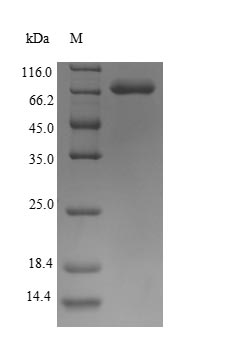 Recombinant Human Keratin, type I cytoskeletal 10 (KRT10) – Figure 1 of 1
