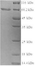 Recombinant Human Keratin, type I cytoskeletal 14 (KRT14) – Figure 1 of 1
