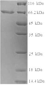 Recombinant Human Keratin, type I cytoskeletal 14 (KRT14) – Figure 1 of 1