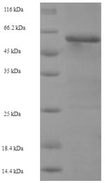 Recombinant Bovine Keratin, type I cytoskeletal 17 (KRT17) – Figure 1 of 1