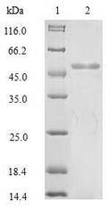 Recombinant Human KeRatin, type I cytoskeletal 18 (KRT18), partial – Figure 1 of 1
