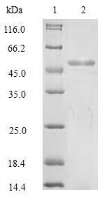 Recombinant Human KeRatin, type I cytoskeletal 18 (KRT18), partial – Figure 1 of 1
