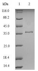 Recombinant Human KeRatin, type I cytoskeletal 18 (KRT18), partial – Figure 1 of 1