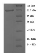 Recombinant Human Keratin, type I cuticular Ha8 (KRT38) – Figure 1 of 1