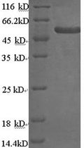 Recombinant Human Keratin, type II cytoskeletal 4 (KRT4) – Figure 1 of 1