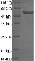 Recombinant Human Keratin, type II cytoskeletal 4 (KRT4) – Figure 1 of 1