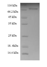 Recombinant Human Keratin,type II cytoskeletal 8 (KRT8), partial – Figure 1 of 1