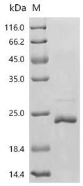 Recombinant Bovine Alpha-lactalbumin (LALBA) – Figure 1 of 1