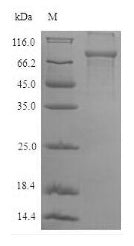 Recombinant Human Plastin-2 (LCP1) – Figure 1 of 1