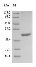 Recombinant Human Leukocyte cell-derived chemotaxin 1 (LECT1), partial – Figure 1 of 1