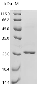 (Tris-Glycine gel) Discontinuous SDS-PAGE (reduced) with 5% enrichment gel and 15% separation gel.