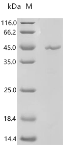 (Tris-Glycine gel) Discontinuous SDS-PAGE (reduced) with 5% enrichment gel and 15% separation gel.
