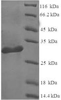 Recombinant Human Galectin-1 (LGALS1) – Figure 1 of 1
