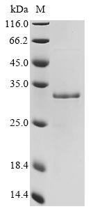 (Tris-Glycine gel) Discontinuous SDS-PAGE (reduced) with 5% enrichment gel and 15% separation gel.