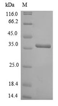 (Tris-Glycine gel) Discontinuous SDS-PAGE (reduced) with 5% enrichment gel and 15% separation gel.
