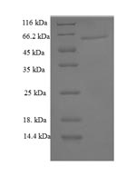 Recombinant Mouse Galectin-6 (Lgals6) – Figure 1 of 1