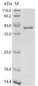 (Tris-Glycine gel) Discontinuous SDS-PAGE (reduced) with 5% enrichment gel and 15% separation gel.