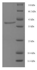 Recombinant Human Lutropin-choriogonadotropic hormone receptor (LHCGR), partial – Figure 1 of 1
