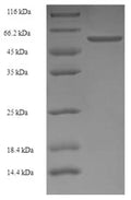 Recombinant Rat Lutropin-choriogonadotropic hormone receptor (Lhcgr), partial – Figure 1 of 1