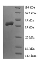 Recombinant Human Lipoyl synthase, mitochondrial (LIAS) – Figure 1 of 1