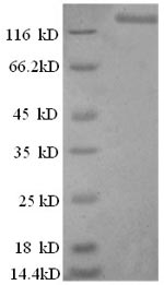 Recombinant Human DNA ligase 1 (LIG1) – Figure 1 of 1