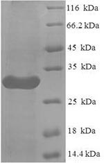 Recombinant Human Leukocyte immunoglobulin-like receptor subfamily A member 5 (LILRA5), partial – Figure 1 of 1