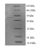 Recombinant Human LIM domain-containing protein 2 (LIMD2) – Figure 1 of 1