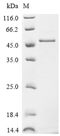 (Tris-Glycine gel) Discontinuous SDS-PAGE (reduced) with 5% enrichment gel and 15% separation gel.