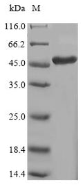 (Tris-Glycine gel) Discontinuous SDS-PAGE (reduced) with 5% enrichment gel and 15% separation gel.