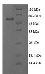 Recombinant Human Lysyl oxidase homolog 1 (LOXL1), partial – Figure 1 of 1
