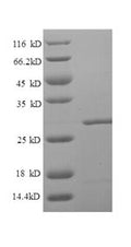 Recombinant Human Lipopolysaccharide-responsive and beige-like anchor protein (LRBA), partial – Figure 1 of 1