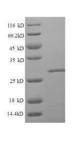 Recombinant Human Lipopolysaccharide-responsive and beige-like anchor protein (LRBA), partial – Figure 1 of 1