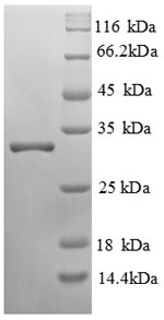 Recombinant Human Lipopolysaccharide-responsive and beige-like anchor protein (LRBA), partial – Figure 1 of 1