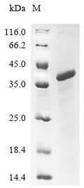 (Tris-Glycine gel) Discontinuous SDS-PAGE (reduced) with 5% enrichment gel and 15% separation gel.