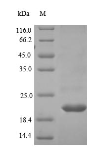 Recombinant Human Low-density lipoprotein receptor-related protein 4 (LRP4), partial – Figure 1 of 1