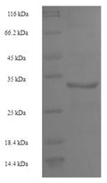 Recombinant Human U6 snRNA-associated Sm-like protein LSm4 (LSM4) – Figure 1 of 1