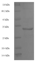 Recombinant Human U6 snRNA-associated Sm-like protein LSm4 (LSM4) – Figure 1 of 1