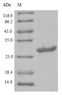 (Tris-Glycine gel) Discontinuous SDS-PAGE (reduced) with 5% enrichment gel and 15% separation gel.